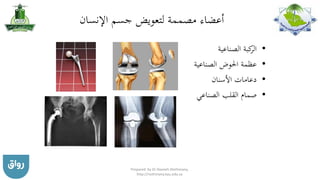 ‫اإلنسان‬ ‫جسم‬ ‫لتعويض‬ ‫مصممة‬ ‫أعضاء‬
•‫الصناعية‬ ‫كبة‬‫الر‬
•‫الصناعية‬ ‫احلوض‬ ‫عظمة‬
•‫األسنان‬ ‫دعامات‬
•‫الصناعي‬ ‫القلب‬ ‫صمام‬
Prepared by Dr Nazeeh Alothmany,
http://nothmany.kau.edu.sa
 