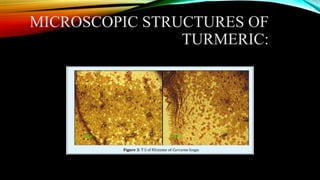 Turmeric Root Powder Under Microscope Formulation , Extraction, Evaluation of Antimicrobial cream from ...