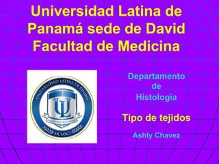Universidad Latina de
Panamá sede de David
Facultad de Medicina
Departamento
de
Histologia
Tipo de tejidos
Ashly Chavez
 