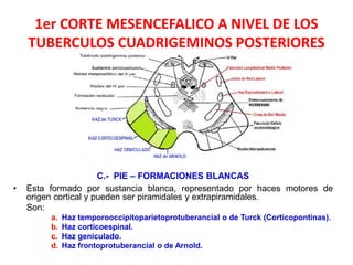 1er CORTE MESENCEFALICO A NIVEL DE LOS
TUBERCULOS CUADRIGEMINOS POSTERIORES
C.- PIE – FORMACIONES BLANCAS
• Esta formado por sustancia blanca, representado por haces motores de
origen cortical y pueden ser piramidales y extrapiramidales.
Son:
a. Haz temporooccipitoparietoprotuberancial o de Turck (Corticopontinas).
b. Haz corticoespinal.
c. Haz geniculado.
d. Haz frontoprotuberancial o de Arnold.
 