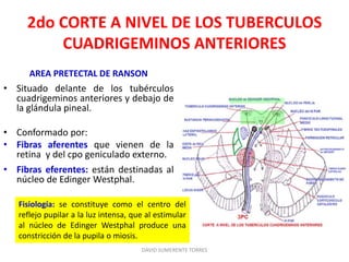 2do CORTE A NIVEL DE LOS TUBERCULOS
CUADRIGEMINOS ANTERIORES
AREA PRETECTAL DE RANSON
• Situado delante de los tubérculos
cuadrigeminos anteriores y debajo de
la glándula pineal.
• Conformado por:
• Fibras aferentes que vienen de la
retina y del cpo geniculado externo.
• Fibras eferentes: están destinadas al
núcleo de Edinger Westphal.
DAVID SUMERENTE TORRES
Fisiología: se constituye como el centro del
reflejo pupilar a la luz intensa, que al estimular
al núcleo de Edinger Westphal produce una
constricción de la pupila o miosis.
 