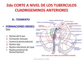2do CORTE A NIVEL DE LOS TUBERCULOS
CUADRIGEMINOS ANTERIORES
B.- TEGMENTO
• FORMACIONES GRISES:
Son
a. Núcleo del III par.
b. Formación reticular.
c. Sustancia periacueductal.
d. Núcleo rojo.
e. Núcleo intersticial de Cajal.
f. Núcleo presticial de
Darkschewitsch.
DAVID SUMERENTE TORRES
 