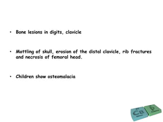 • Bone lesions in digits, clavicle
• Mottling of skull, erosion of the distal clavicle, rib fractures
and necrosis of femoral head.
• Children show osteomalacia
 