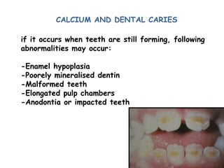 CALCIUM AND DENTAL CARIES
if it occurs when teeth are still forming, following
abnormalities may occur:
-Enamel hypoplasia
-Poorely mineralised dentin
-Malformed teeth
-Elongated pulp chambers
-Anodontia or impacted teeth
 