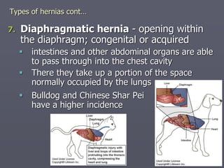Shars Chest 7 VM 451_Hernia_20-21.pdfbbvvbvnvvvvvvvbvv | PDF