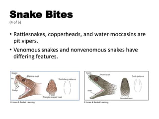 Snake Bites
(4 of 6)
• Rattlesnakes, copperheads, and water moccasins are
pit vipers.
• Venomous snakes and nonvenomous snakes have
differing features.
© Jones & Bartlett Learning. © Jones & Bartlett Learning.
 