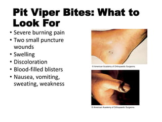 Pit Viper Bites: What to
Look For
• Severe burning pain
• Two small puncture
wounds
• Swelling
• Discoloration
• Blood-filled blisters
• Nausea, vomiting,
sweating, weakness
© American Academy of Orthopaedic Surgeons.
© American Academy of Orthopaedic Surgeons.
 