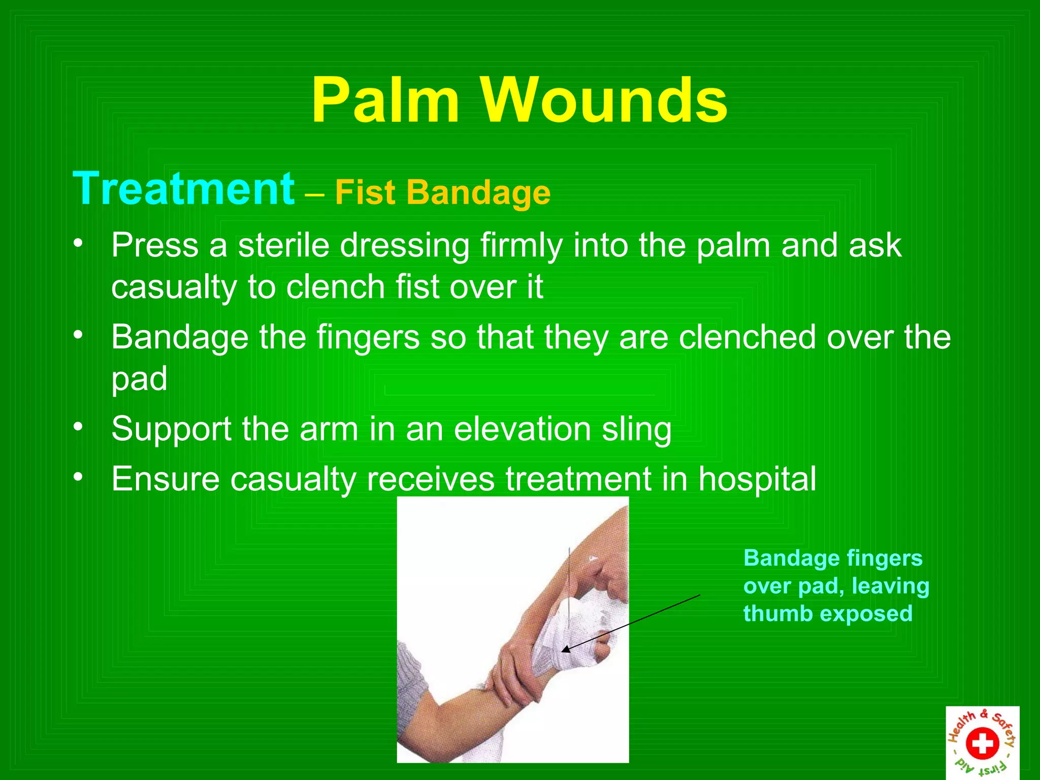 Palm Wounds
Treatment – Fist Bandage
• Press a sterile dressing firmly into the palm and ask
  casualty to clench fist over it
• Bandage the fingers so that they are clenched over the
  pad
• Support the arm in an elevation sling
• Ensure casualty receives treatment in hospital

                                          Bandage fingers
                                          over pad, leaving
                                          thumb exposed
 