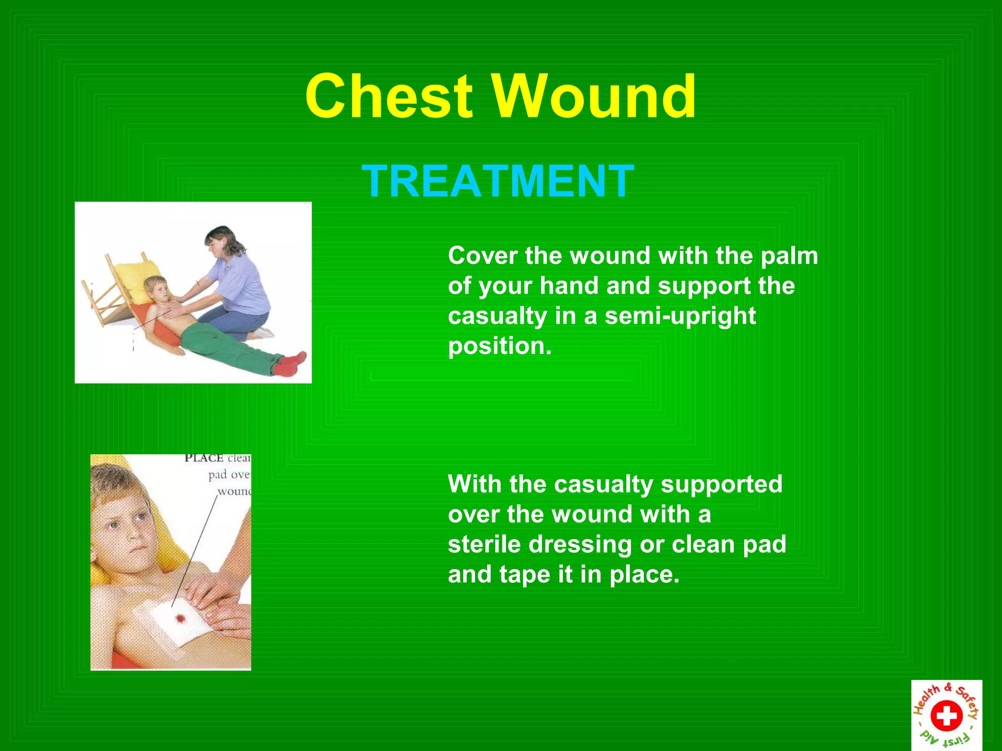 Chest Wound
 TREATMENT
    Cover the wound with the palm
    of your hand and support the
    casualty in a semi-upright
    position.




    With the casualty supported
    over the wound with a
    sterile dressing or clean pad
    and tape it in place.
 