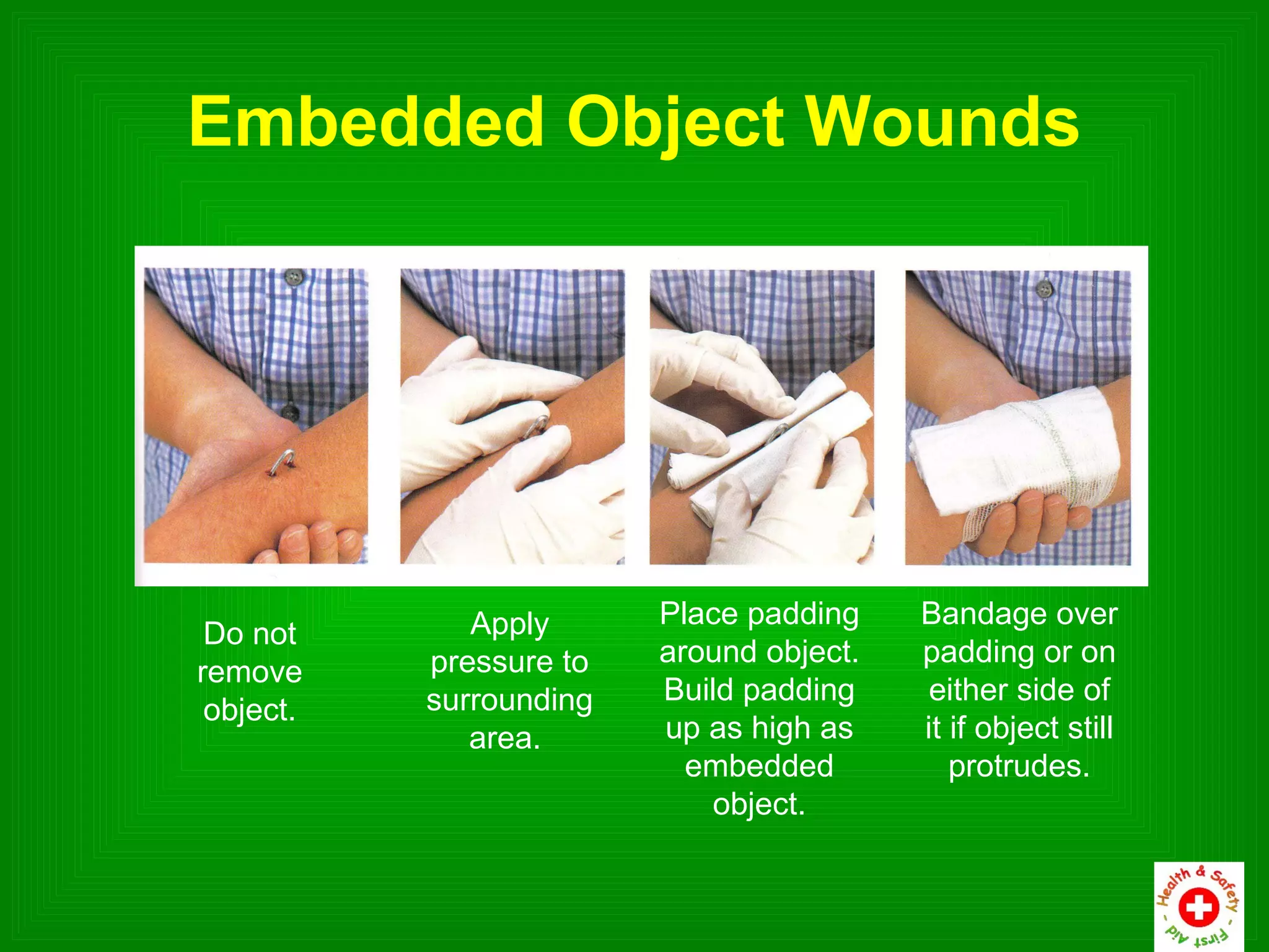 Embedded Object Wounds




              Apply      Place padding    Bandage over
 Do not
           pressure to   around object.   padding or on
remove
           surrounding   Build padding     either side of
 object.
              area.      up as high as    it if object still
                           embedded          protrudes.
                            object.
 