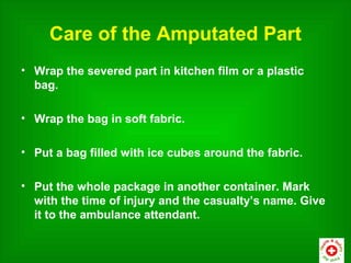 Care of the Amputated Part
• Wrap the severed part in kitchen film or a plastic
  bag.

• Wrap the bag in soft fabric.

• Put a bag filled with ice cubes around the fabric.

• Put the whole package in another container. Mark
  with the time of injury and the casualty’s name. Give
  it to the ambulance attendant.
 