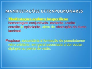 • Manifestações oculares inespecíficas:
hemorragias conjuntivais, esclerite, uveíte,
ceratite e episclerite, além de obstrução do ducto
lacrimal.
Proptose, secundária à formação de pseudotumor
retro orbitário, em geral associada a dor ocular,
diplopia ou perda de visão.
 