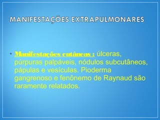 • Manifestações cutâneas : úlceras,
púrpuras palpáveis, nódulos subcutâneos,
pápulas e vesículas. Pioderma
gangrenoso e fenônemo de Raynaud são
raramente relatados.
 