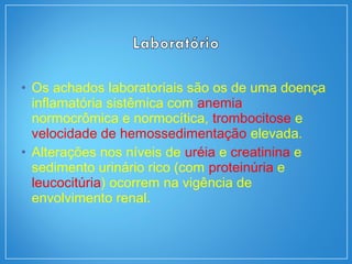• Os achados laboratoriais são os de uma doença
inflamatória sistêmica com anemia
normocrômica e normocítica, trombocitose e
velocidade de hemossedimentação elevada.
• Alterações nos níveis de uréia e creatinina e
sedimento urinário rico (com proteinúria e
leucocitúria) ocorrem na vigência de
envolvimento renal.
 