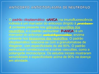 • O padrão citoplasmático (cANCAcANCA) na imunofluorescência
indireta é um marcador do anticorpo dirigido à proteinase-
3, protease presente nos grânulos azurófilos dos
neutrófilos, e o padrão perinuclear (P-ANCAP-ANCA) é um
marcador do anticorpo antimieloperoxidase, enzima
presente nos lisossomos dos neutrófilos. O padrão
citoplasmático relaciona-se com a granulomatose de
Wegener, com especificidade de até 90%. O padrão
perinuclear correlaciona-se a outras vasculites, como a
poliangeíte microscópica. Os estudos iniciais mostraram
sensibilidade e especificidade acima de 90% na doença
em atividade.
 