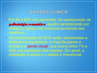 • Em 40 a 50% dos pacientes, há superposição de
polimialgia reumáticapolimialgia reumática, quadro caracterizado por
mialgia e rigidez dos músculos proximais dos
membros.
• As complicações da ACG estão relacionadas a
fenômenos isquêmicos. A mais freqüente e
temida é a perda visual, que ocorre entre 7% e
60% dos pacientes não tratados. Em geral, a
instalação é súbita e o defeito é irreversível.
 