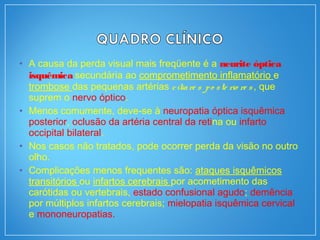 • A causa da perda visual mais freqüente é a neurite óptica
isquêmica secundária ao comprometimento inflamatório e
trombose das pequenas artérias ciliare s po ste rio re s , que
suprem o nervo óptico.
• Menos comumente, deve-se à neuropatia óptica isquêmica
posterior, oclusão da artéria central da retina ou infarto
occipital bilateral.
• Nos casos não tratados, pode ocorrer perda da visão no outro
olho.
• Complicações menos frequentes são: ataques isquêmicos
transitórios ou infartos cerebrais por acometimento das
carótidas ou vertebrais, estado confusional agudo; demência
por múltiplos infartos cerebrais; mielopatia isquêmica cervical
e mononeuropatias.
 