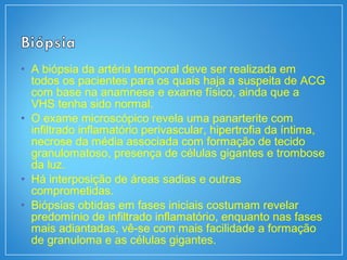 • A biópsia da artéria temporal deve ser realizada em
todos os pacientes para os quais haja a suspeita de ACG
com base na anamnese e exame físico, ainda que a
VHS tenha sido normal.
• O exame microscópico revela uma panarterite com
infiltrado inflamatório perivascular, hipertrofia da íntima,
necrose da média associada com formação de tecido
granulomatoso, presença de células gigantes e trombose
da luz.
• Há interposição de áreas sadias e outras
comprometidas.
• Biópsias obtidas em fases iniciais costumam revelar
predomínio de infiltrado inflamatório, enquanto nas fases
mais adiantadas, vê-se com mais facilidade a formação
de granuloma e as células gigantes.
 