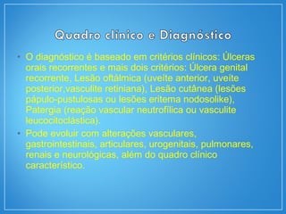 • O diagnóstico é baseado em critérios clínicos: Úlceras
orais recorrentes e mais dois critérios: Úlcera genital
recorrente, Lesão oftálmica (uveíte anterior, uveíte
posterior,vasculite retiniana), Lesão cutânea (lesões
pápulo-pustulosas ou lesões eritema nodosolike),
Patergia (reação vascular neutrofílica ou vasculite
leucocitoclástica).
• Pode evoluir com alterações vasculares,
gastrointestinais, articulares, urogenitais, pulmonares,
renais e neurológicas, além do quadro clínico
característico.
 
