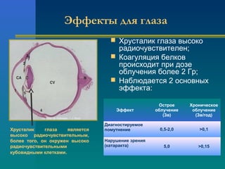 Эффекты для глаза 
 Хрусталик глаза высоко 
радиочувствителен; 
 Коагуляция белков 
происходит при дозе 
облучения более 2 Гр; 
 Наблюдается 2 основных 
эффекта: 
Из “Atlas de Histologia...”. J. Boya 
Хрусталик глаза является 
высоко радиочувствительным, 
более того, он окружен высоко 
радиочувствительными 
кубовидными клетками. 
Эффект 
Острое 
облучение 
(Зв) 
Хроническое 
облучение 
(Зв/год) 
Диагностируемое 
помутнение 0,5-2,0 >0,1 
Нарушение зрения 
(катаракта) 5,0 >0,15 
 