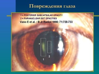 Повреждения глаза 
 