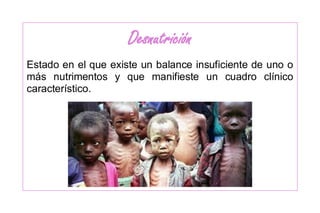 Desnutrición
Estado en el que existe un balance insuficiente de uno o
más nutrimentos y que manifieste un cuadro clínico
característico.
 