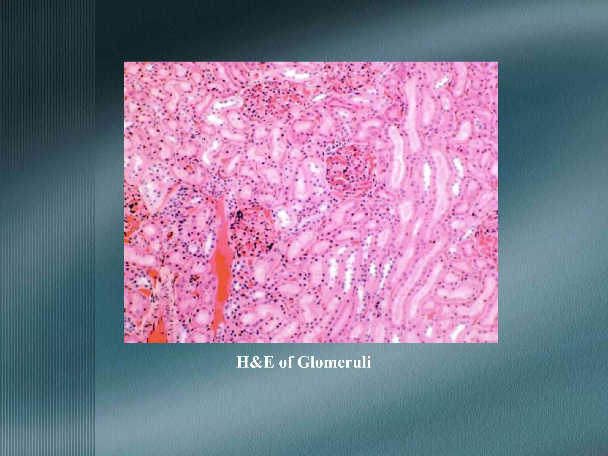 H&E of Glomeruli
 