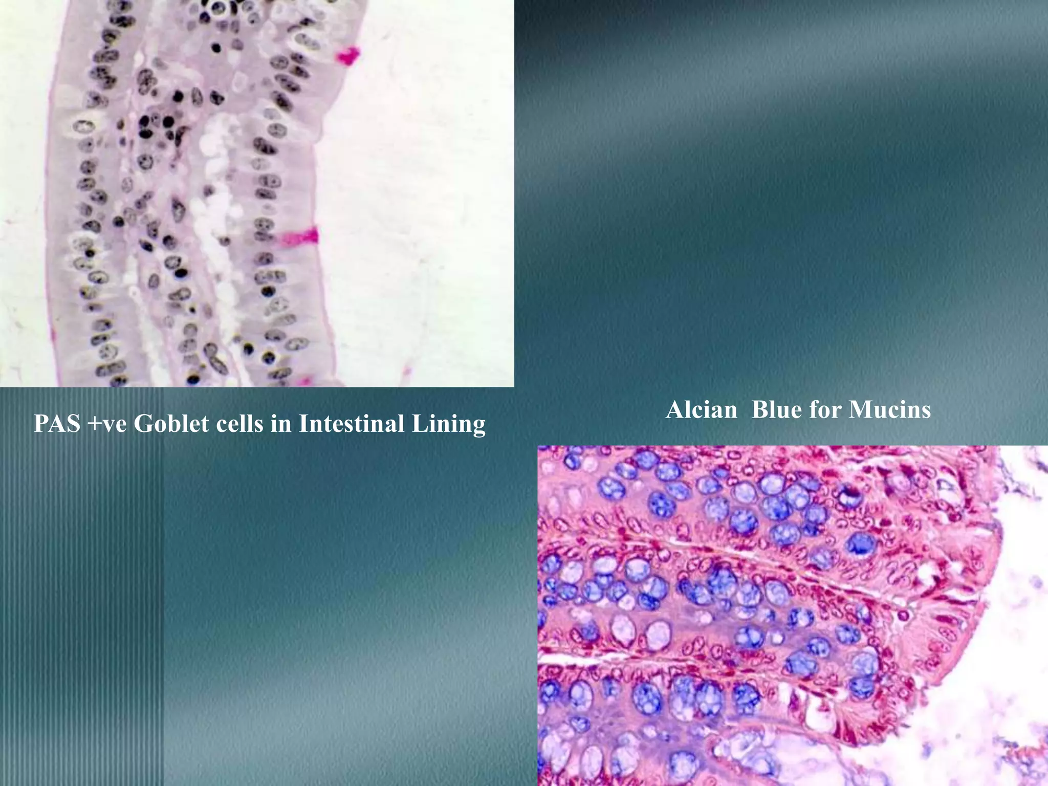 PAS +ve Goblet cells in Intestinal Lining
Alcian Blue for Mucins
 