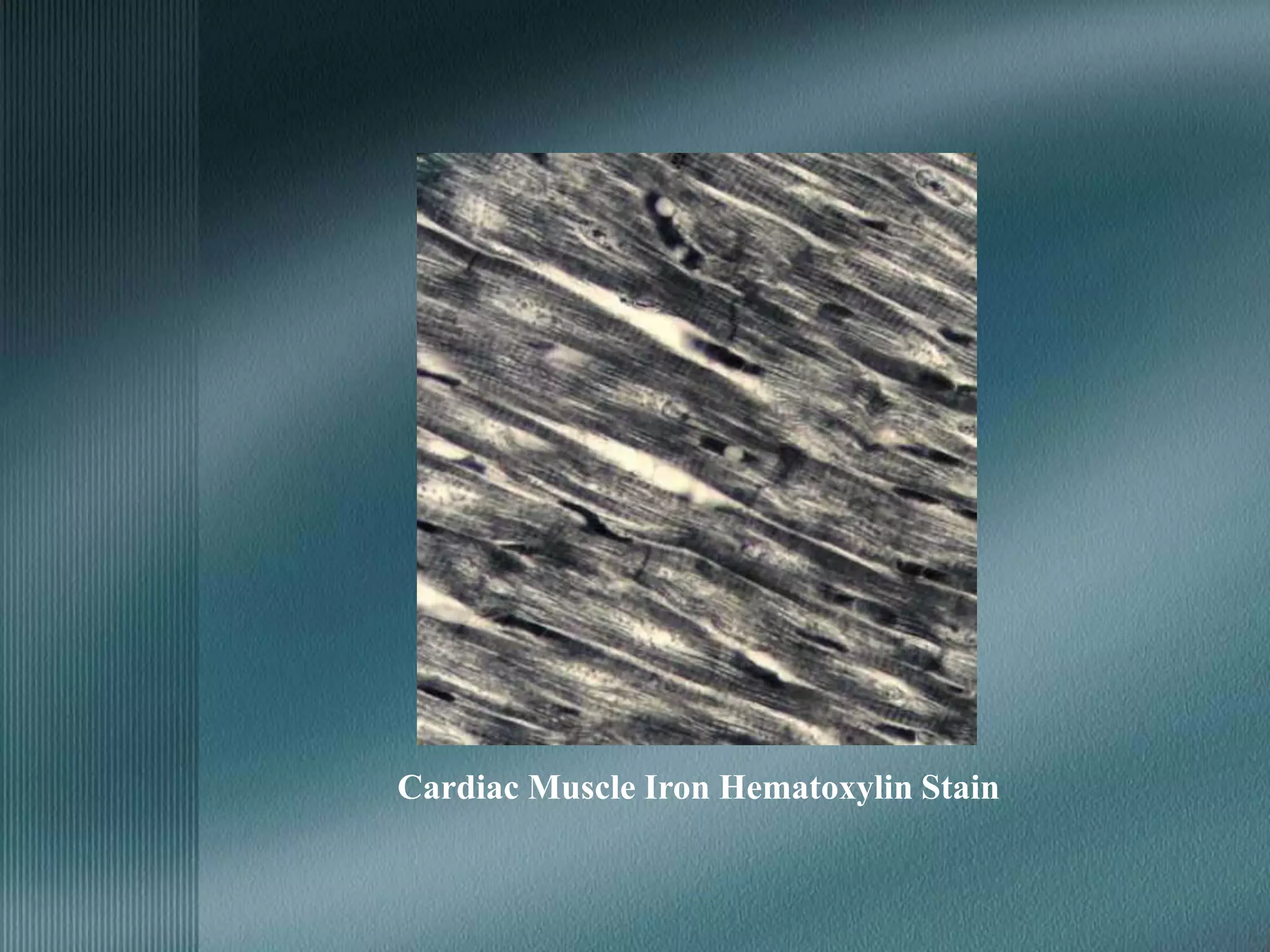 Cardiac Muscle Iron Hematoxylin Stain
 