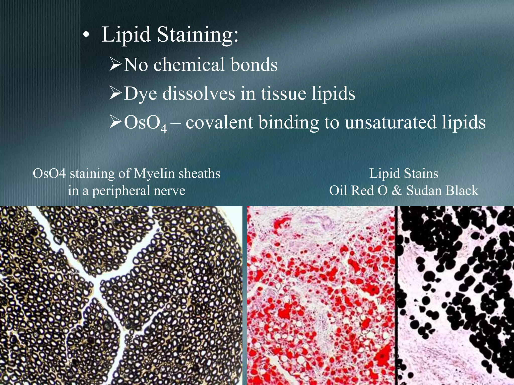 • Lipid Staining:
No chemical bonds
Dye dissolves in tissue lipids
OsO4 – covalent binding to unsaturated lipids
OsO4 staining of Myelin sheaths
in a peripheral nerve
Lipid Stains
Oil Red O & Sudan Black
 