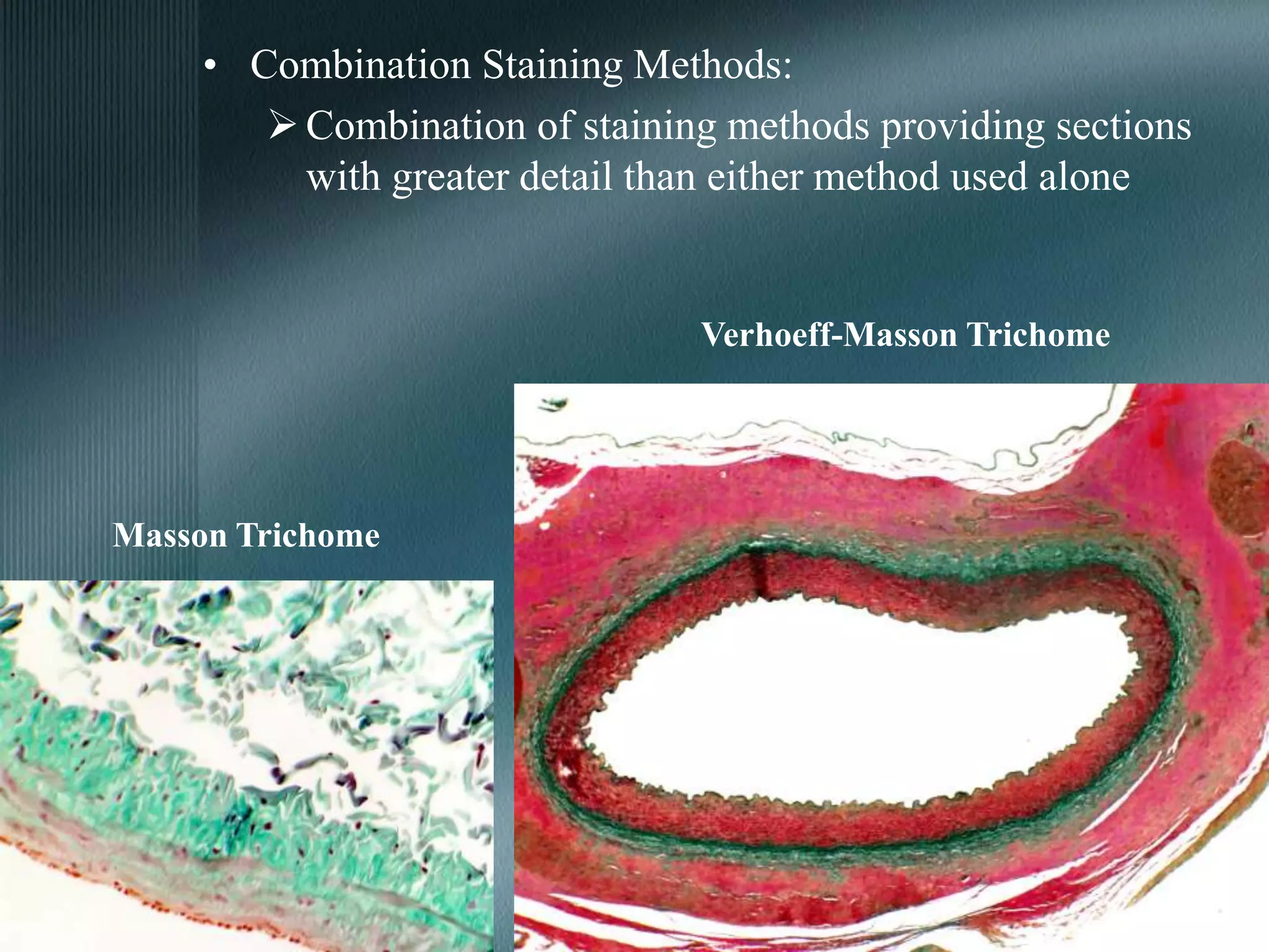 • Combination Staining Methods:
Combination of staining methods providing sections
with greater detail than either method used alone
Verhoeff-Masson Trichome
Masson Trichome
 