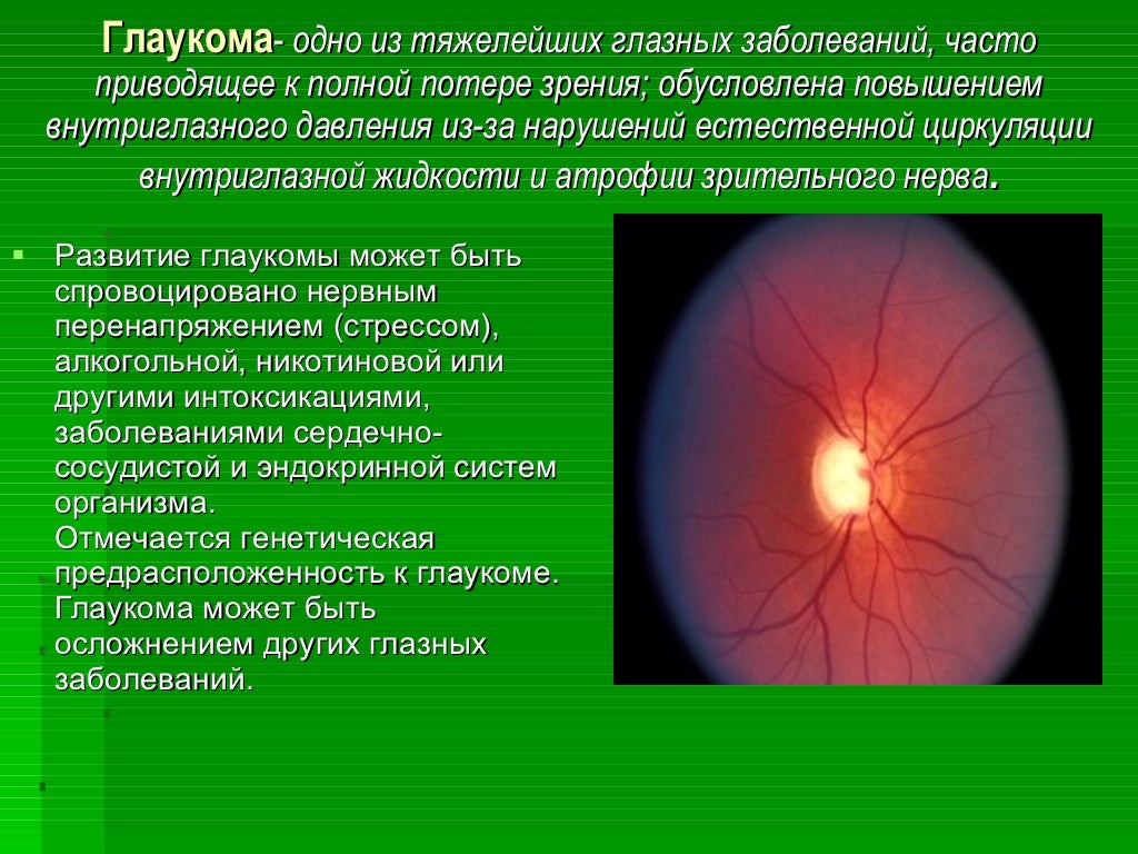 Гигиена зрения 8 класс биология. Гигиена зрения. Зрение -8,75.