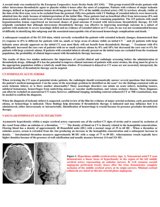 Topic of the month...Neuroimaging of embolic cerebral infarctions | PDF