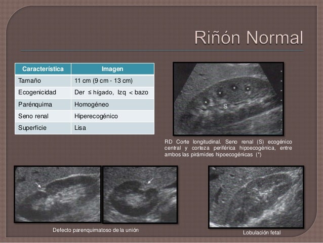 Clase de Riñon - Ecografia