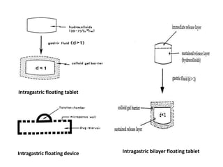 Intragastric floating tablet

Intragastric floating device

Intragastric bilayer floating tablet

 