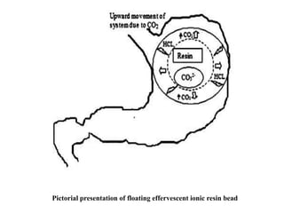 Pictorial presentation of floating effervescent ionic resin bead

 
