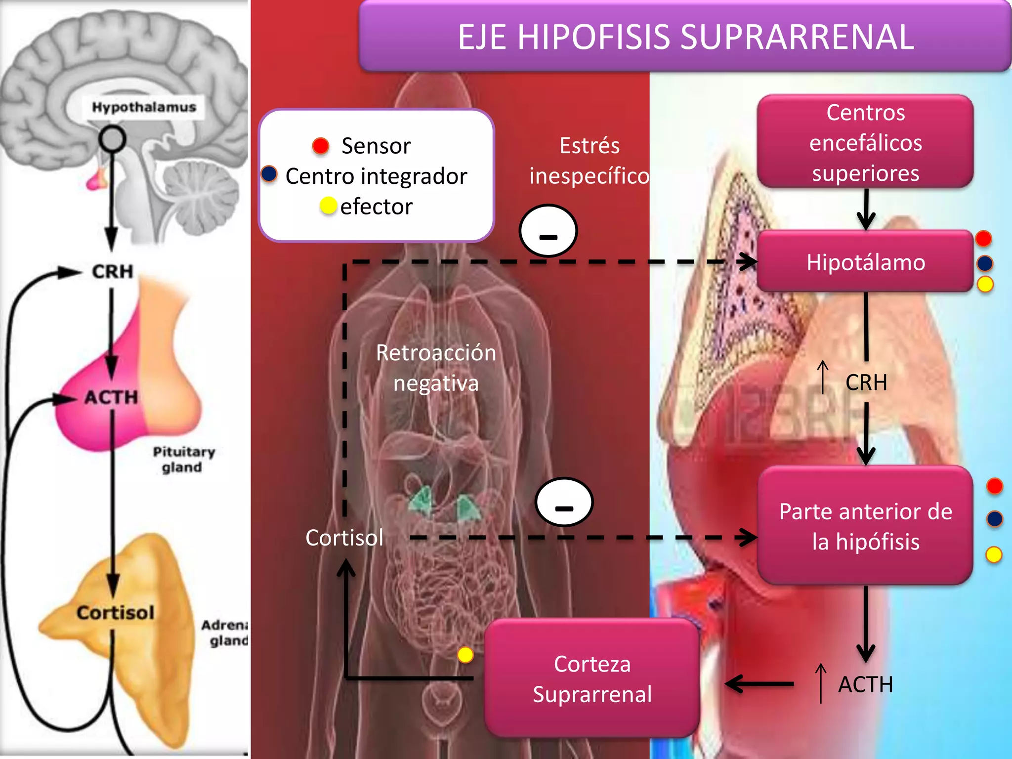 what does sip mean in death
