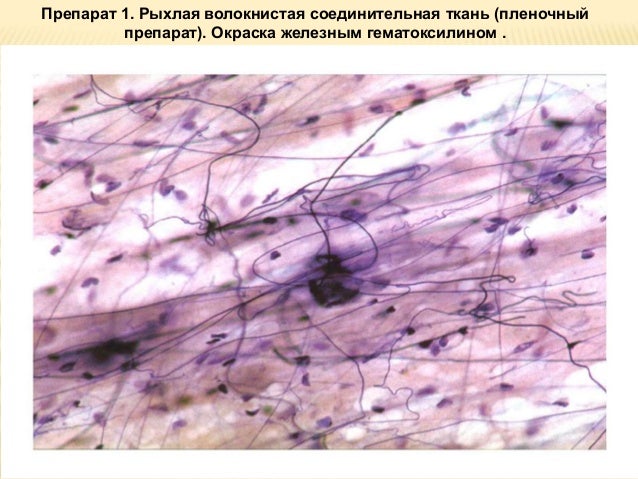 Жункейра Карнейро Гистология