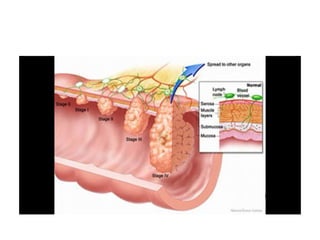 8.  patologia colo rectal