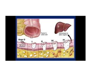 8.  patologia colo rectal