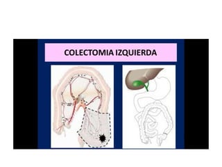 8.  patologia colo rectal