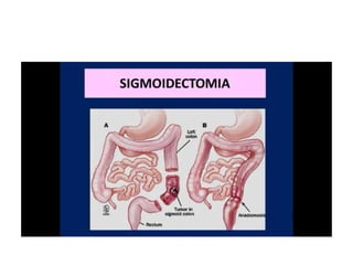8.  patologia colo rectal