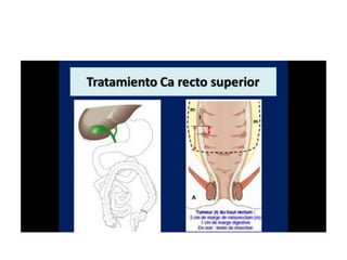 8.  patologia colo rectal