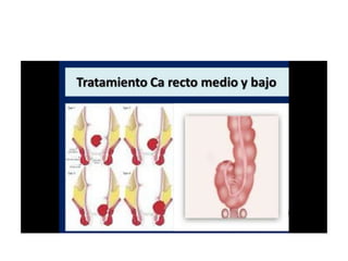 8.  patologia colo rectal