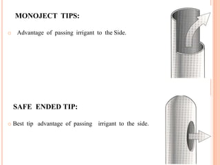 MONOJECT TIPS:
o Advantage of passing irrigant to the Side.
SAFE ENDED TIP:
o Best tip advantage of passing irrigant to the side.
12
 