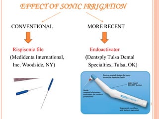 EFFECT OF SONIC IRRIGATION
CONVENTIONAL MORE RECENT
Rispisonic file Endoactivator
(Medidenta International, (Dentsply Tulsa Dental
Inc, Woodside, NY) Specialties, Tulsa, OK)
31
 