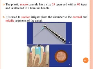  The plastic macro cannula has a size 55 open end with a .02 taper
and is attached to a titanium handle.
 It is used to suction irrigant from the chamber to the coronal and
middle segments of the canal.
45
 