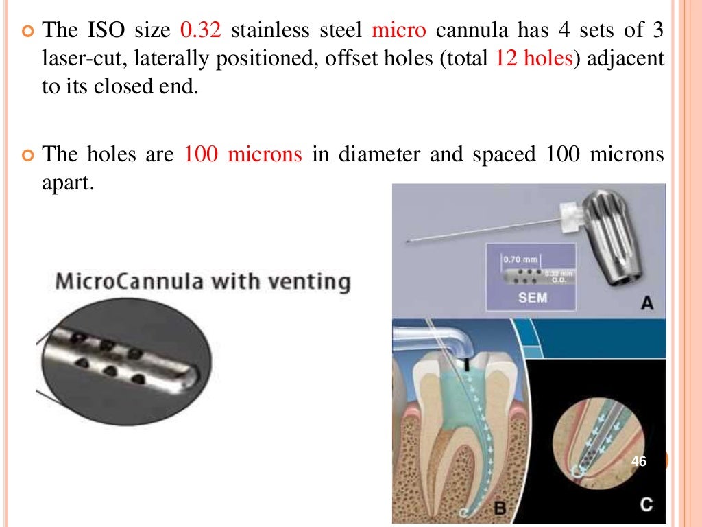 Recent advances in endodontic irrigation devices