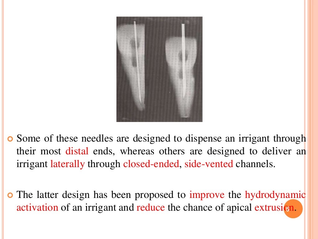 Recent advances in endodontic irrigation devices
