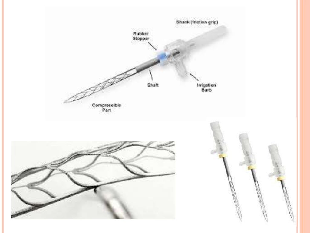 Recent advances in endodontic irrigation devices